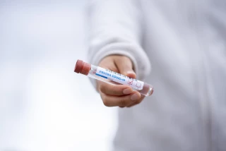 Dépistage du Covid-19 : 4 % de positivité